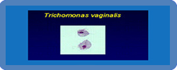 Trichomoniasis vaginitis
